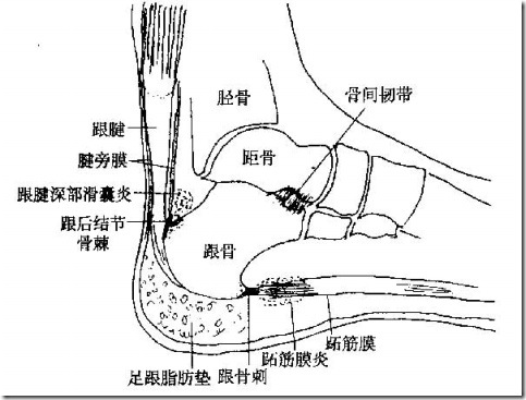 一 足跟痛的解剖学机制