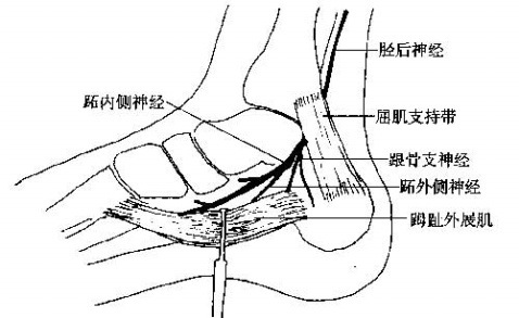 内侧突较大,上有拇展肌,趾短屈肌和跖腱膜附着.